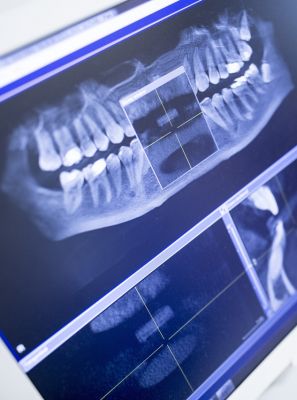 Ortodontia Digital: Scanners e Simuladores Transformam Sorrisos