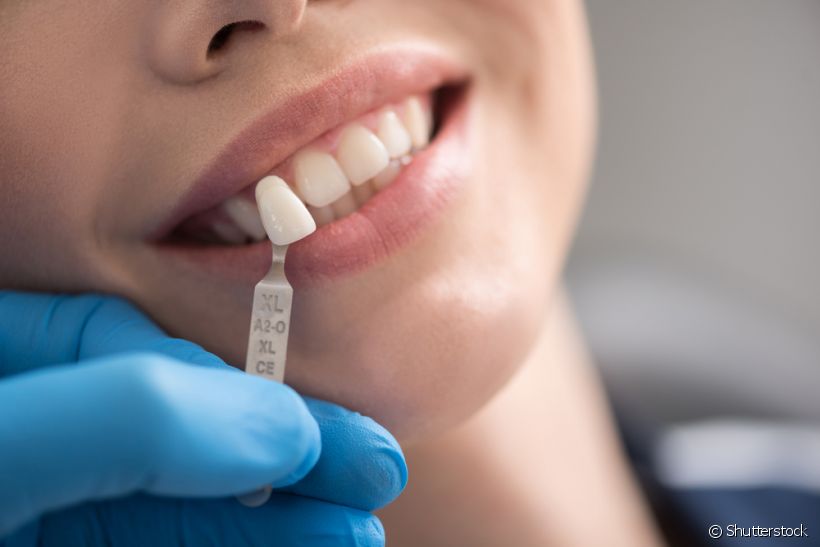 A peri-implantite é uma das causas mais comuns para a perda do implante dentário. Você já ouviu falar nessa doença? Saiba mais a seguir