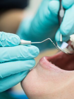Tártaro na contenção ortodôntica fixa: como remover? Maneiras de evitar o acúmulo de placa bacteriana atrás dos dentes