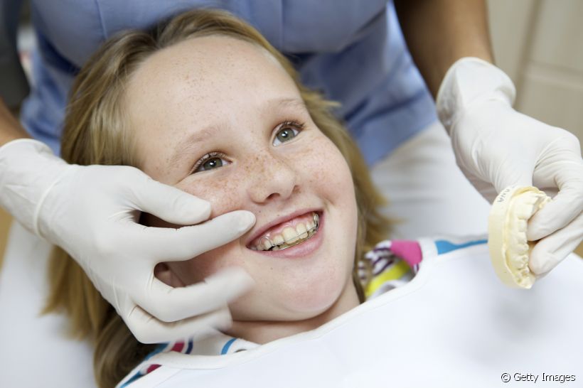 Sorriso gengival vs aparelho ortodôntico: entenda a relação entre o tratamento e a condição bucal