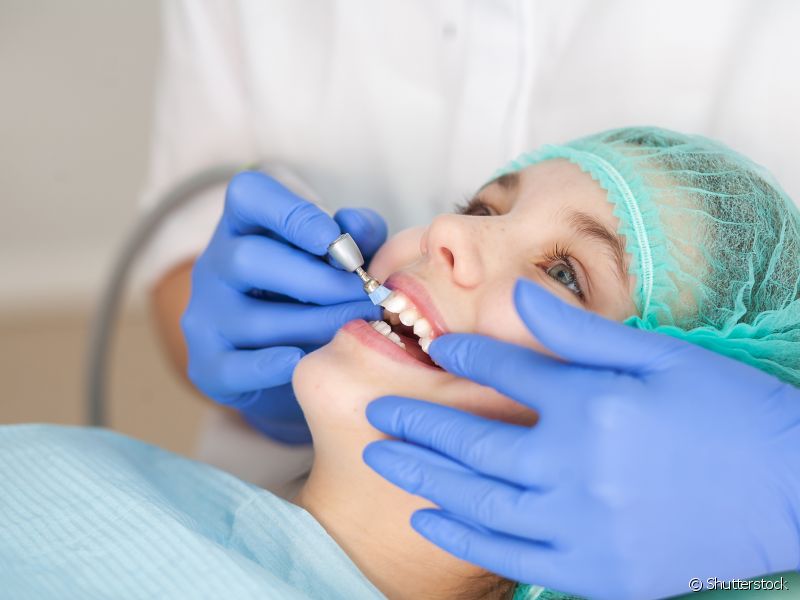 Depois de eliminar a placa bacteriana, o dentista vai escovar os seus dentes com um creme dental específico disponível no consultório