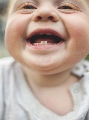 Nascimento do dente de leite causa febre? Como tratar?