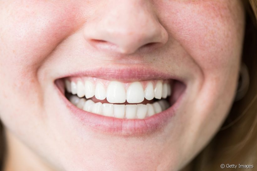 O clareamento dental é a técnica ideal para deixar os dentes brancos e saudáveis. Veja como esse tratamento funciona e os cuidados necessários após a sua realização!
