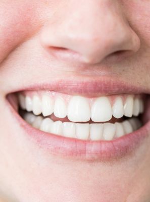 Como é feito o clareamento dental? Técnica que pode deixar seus dentes brancos