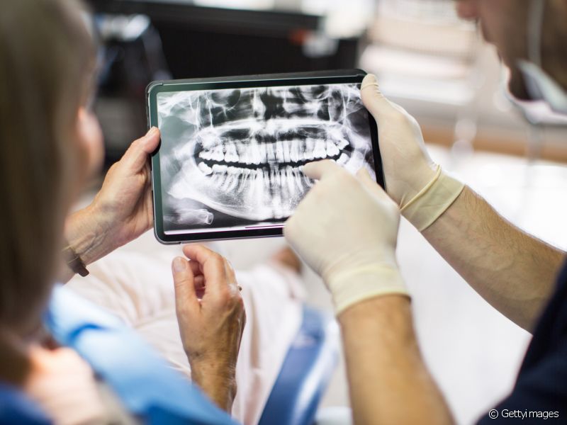 O dentista precisa identificar a origem desse abscesso dentário. Entender se foi causado por uma periodontite, cárie, necrose ou alguma fratura para iniciar o tratamento que pode ser diferentes, dependendo do motivo.
