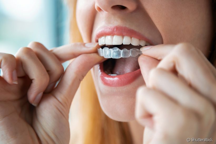 Assim como o modelo tradicional, o aparelho transparante também pode causar dor de dente no início do tratamento ortodôntico. Veja dicas de um profissional para amenizar o quadro!