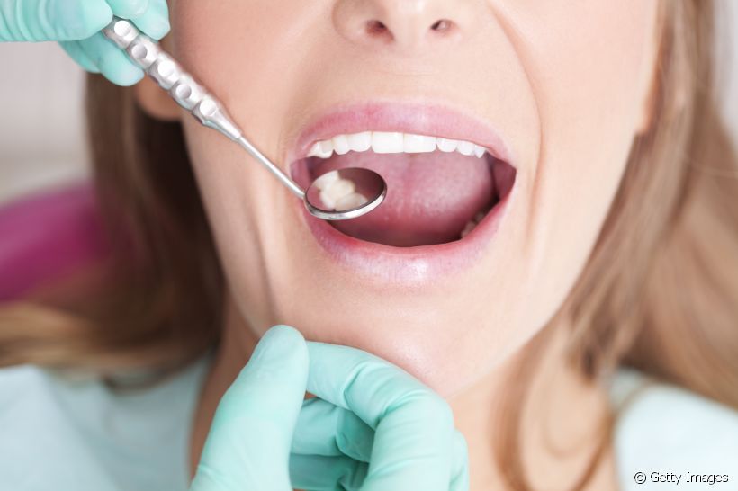 A restauração dentária requer alguns cuidados para garantir a sua durabilidade. Veja quais são eles!