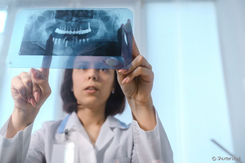 Saiba como a radiografia panorâmica funciona e os benefícios desse tipo de exame para sua saúde bucal