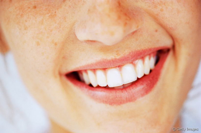 Um enxerto no dente requer alguns cuidados importantes para garantir um bom resultado do procedimento. Veja quais são com a ajuda de uma especialista!