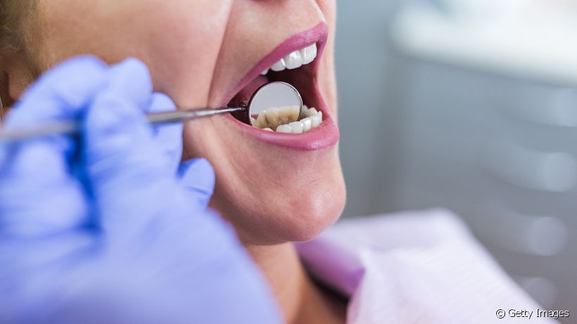 A afta na gengiva perto do dente pode ser causada por diversos fatores, incluindo estresse e falta de nutrientes e vitaminas. Saiba como tratar o quadro!  