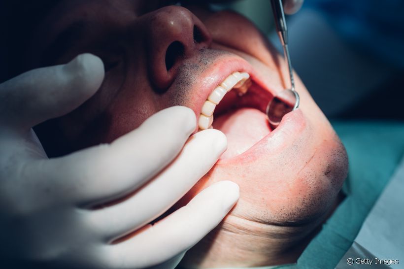 Descubra quais são as melhores opções de restauração dentária e os cuidados necessários após o procedimento
