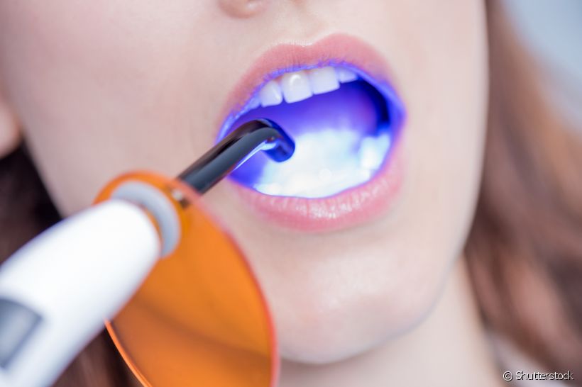 O fotopolimerizador pode contribuir para uma série de tratamentos odontológicos, como a restauração dental. Entenda!