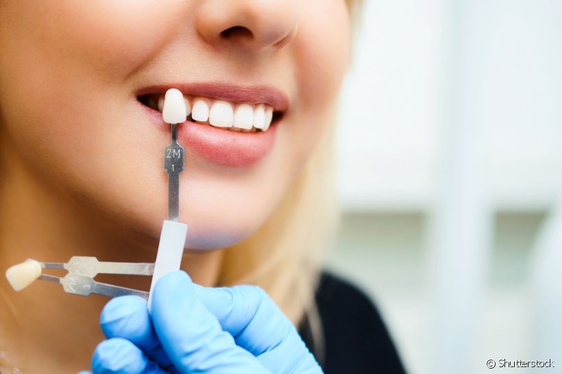 Entenda como funciona a lente de contato dental e descubra se o procedimento exige o desgaste dentário