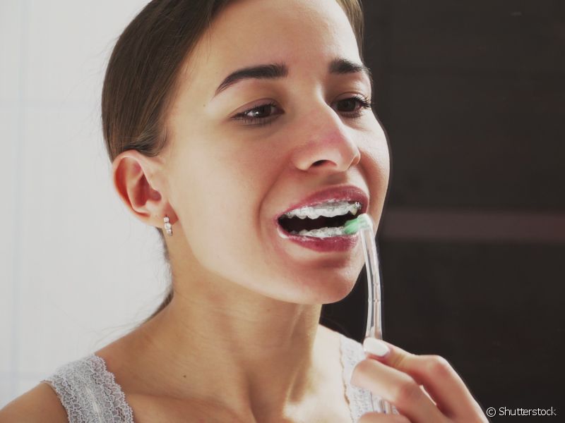 Realize a limpeza dos dentes e do aparelho ortodôntico. Seja com uma escova convencional ou um model em forma de 