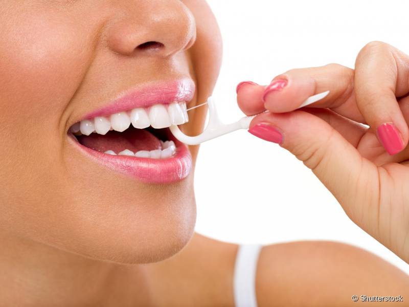 Escolha um fio dental superfloss ou passa fio, modelos indicados especialmente para quem usa aparelho ortodôntico.