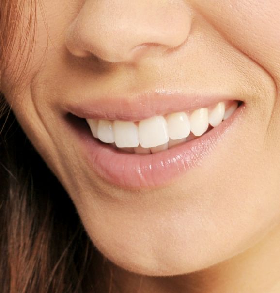 O clareamento dental é a técnica que se tornou muito popular nos últimos anos devido ao apelo estético por dentes brancos e bem alinhados