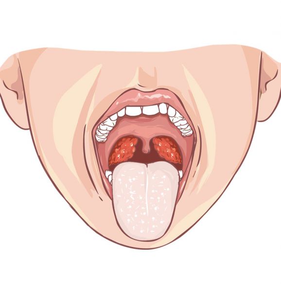 A língua apresenta um aspecto rosado e lisinho, isso quer dizer que ela está bem saudável. Do contrário, ela ficará esbranquiçada e descamada, causando várias complicações bucais