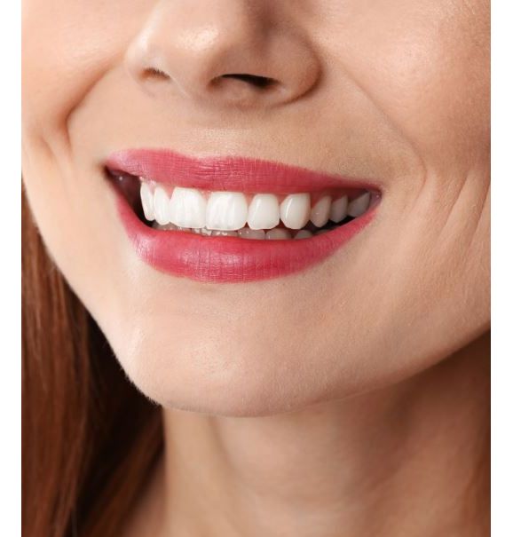 Antes e depois da profilaxia: veja como a limpeza do dentista faz toda a diferença no seu sorriso
