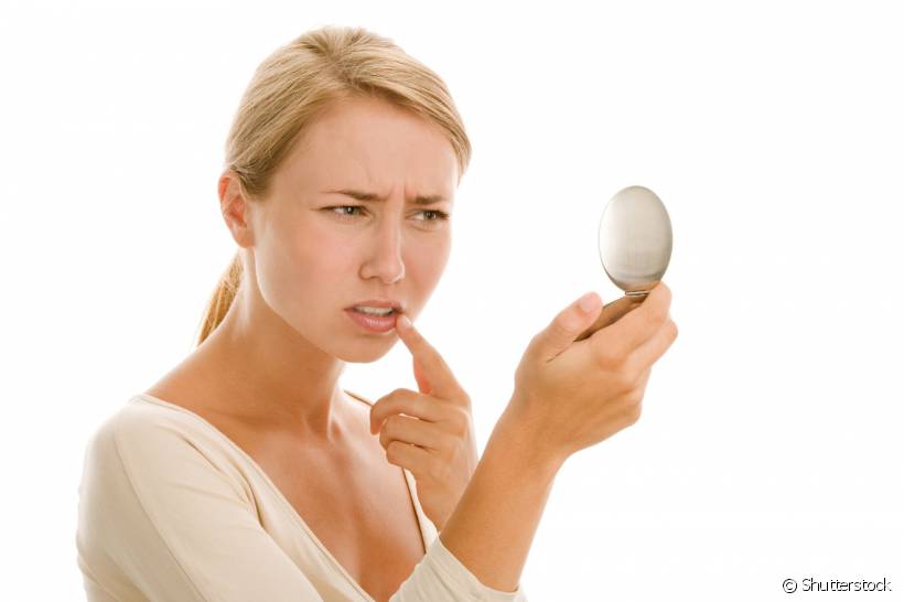Após a adolescência o surgimento de acne continua permanente na moria das mulheres, principalmente ao redor da boca