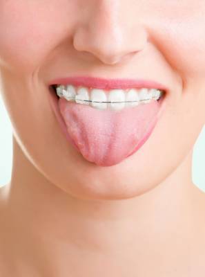 Tratamento ortodôntico: escovar a língua acaba com a Saburra Língual. Descubra os benefícios dessa higiene