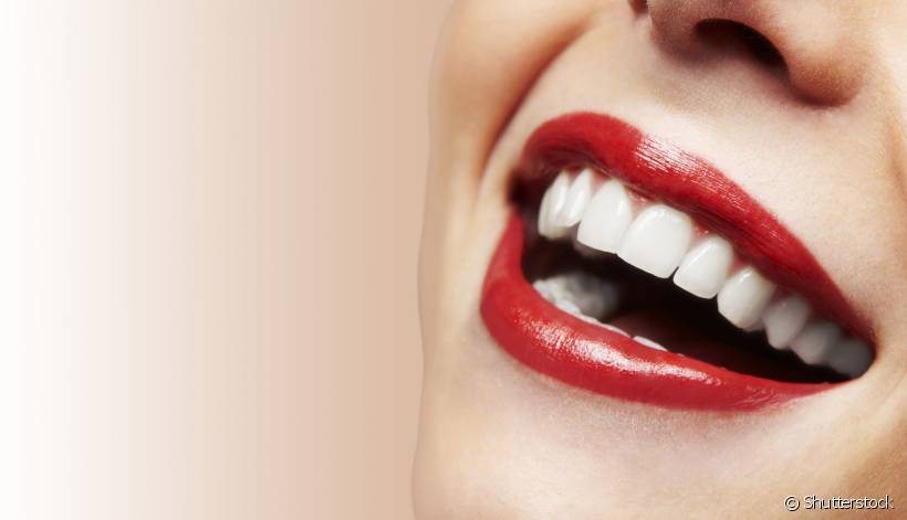 A lente de contato dental é excelente não só para melhorar a estética do sorriso, como corrigir defeitos estruturais como anomalias dentais. Conheça mais sobre essa técnica