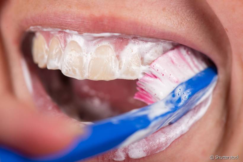 Como escovar os dentes corretamente? Existem pessoas que escovam em excesso, mas será que é o certo? Um dentista responde ao Sorrisologia
