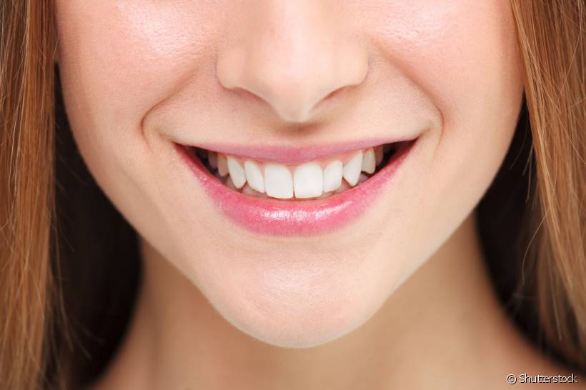 Após o tratamento ortodôntico você pode notar seus dentes com um aspecto amarelado. Seu dentista pode indicar aplicação de flúor e até o clareamento dental