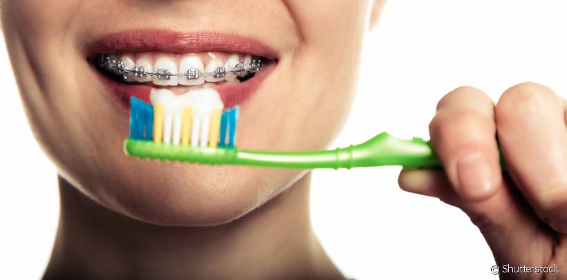 Se o momento da higiene bucal é mais complicadinho para quem usa aparelho dentário, existe uma ferramenta essencial para esses casos: a escova ortodôntica