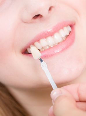 Qual é a diferença entre faceta de porcelana e lente de contato dental?