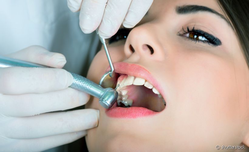 A cárie oculta se instala nos dentes e, geralmente, não dá muitos sinais. Para detectar o problema e tratar o quanto antes só visitando seu dentista