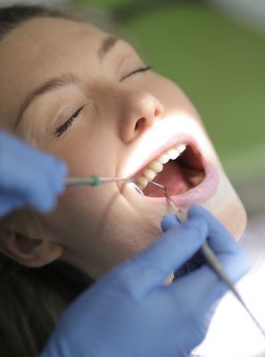 Abfração dental: o que é, quais as causas e como evitar?