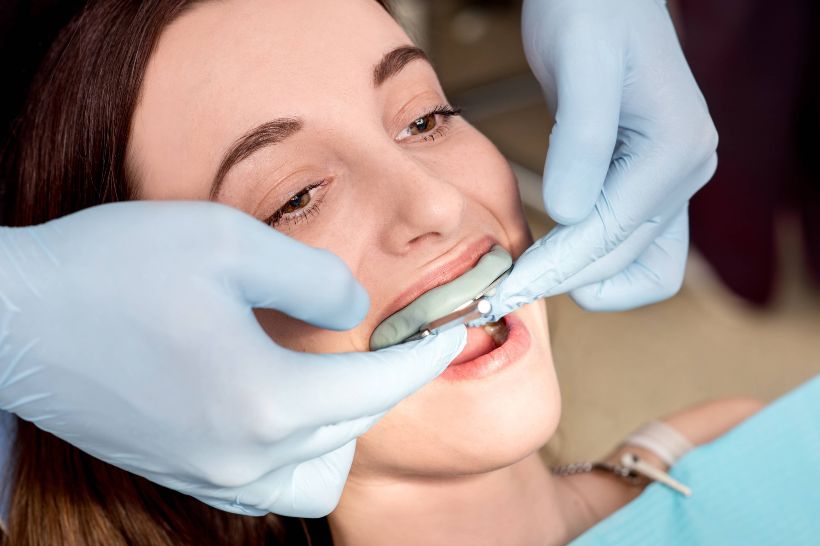 O hábito de ranger os dentes, também chamado de bruxismo, pode acabar enfraquecendo os dentes e abrindo espaço para outros problemas de saúde bucal