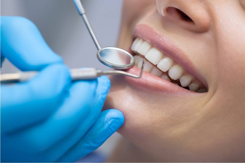 O tártaro no dente só pode ser removido no dentista, mas a prevenção deve ser feita em casa.