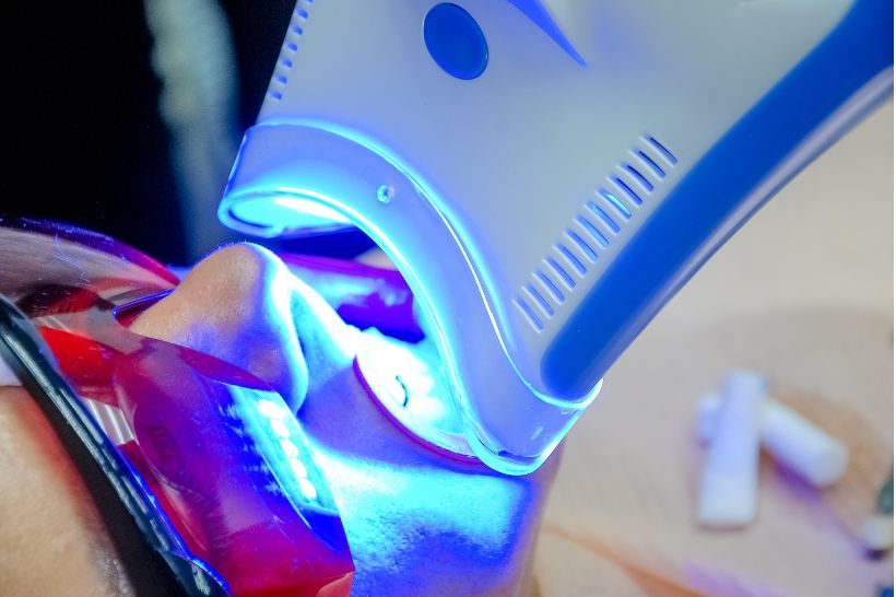 O clareamento dental tem mais sucesso em manchas mais brandas, mas pode funcionar em todas a depender da técnica e da intensidade do tratamento