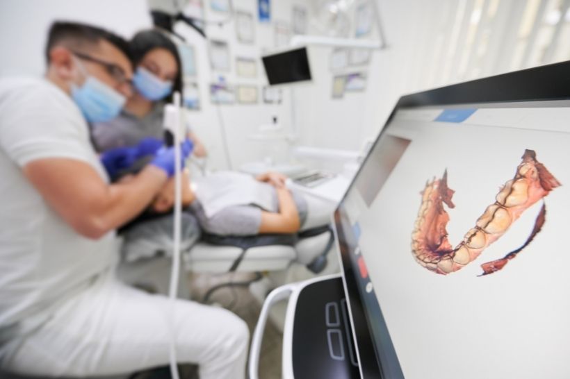 O scanner intraoral pode facilitar a produção de próteses dentárias, coroas e placas de bruxismo.