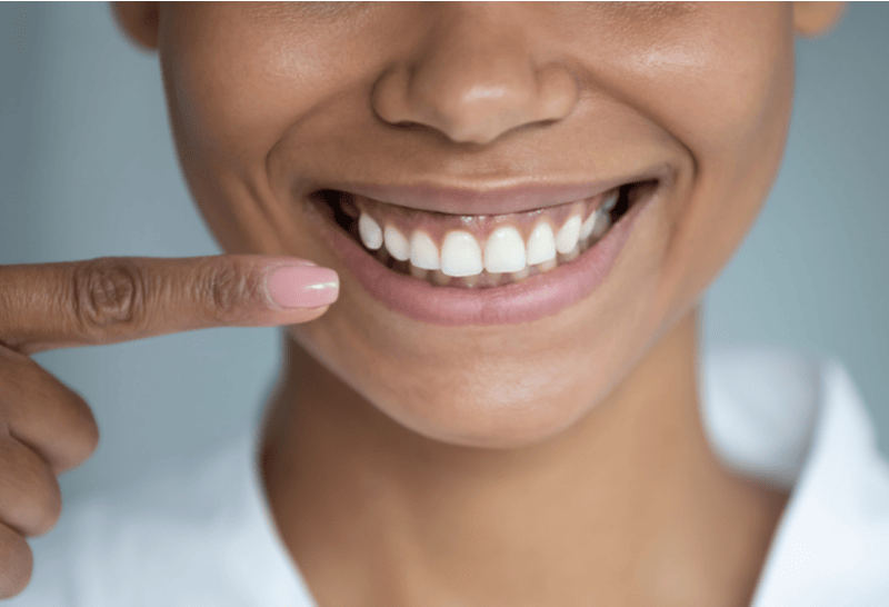 Gengiva crescendo sobre os seus dentes pode ser um sinal de inflamação local. Conheça as possíveis causas e tratamento
