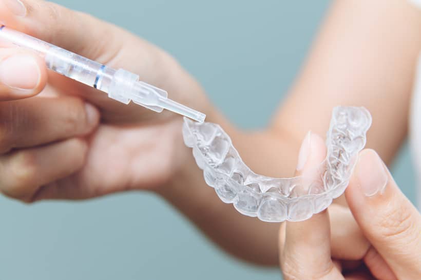 Clareamento dos dentes com moldeira é prático, mas requer uma série de cuidados. Veja tudo o que você precisa saber sobre o tratamento