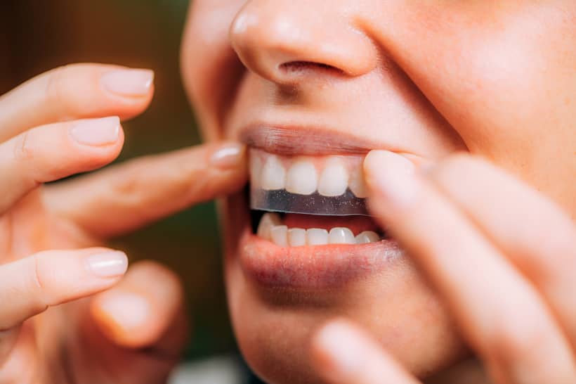 Fitas para clareamento dental prometem um efeito branqueador, mas será que são tão potentes quanto as moldeiras? 