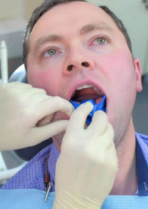 Protetor bucal: dentista dá dicas de uso e limpeza