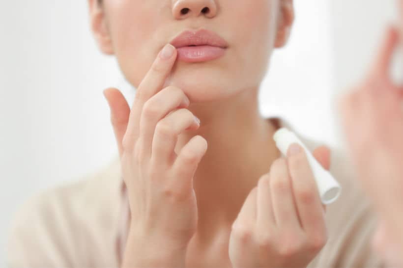 Para tratar lesões na boca como o herpes labial, é importante usar hidratantes e pomadas que amenizam a dor e aceleram a cicatrização