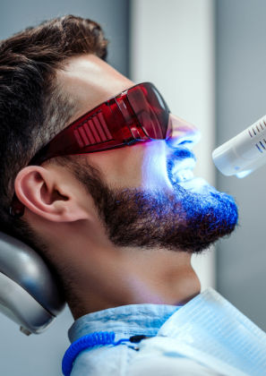 Clareamento dental: quem tem sensibilidade pode fazer o procedimento?