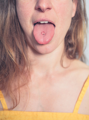 Como piercing na língua pode danificar seus dentes?